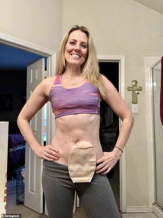 As a personal trainer who also did nutrition coaching, she worried about being judged for her colostomy bag: ‘I felt a lot of shame around it and a lot of “what did I do wrong?”’