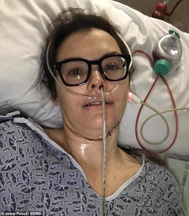 Powell had a section of her tongue surgically removed on March 23, 2020, just as Covid was getting its grip on the world