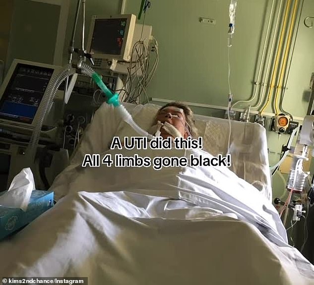 When Smith was airlifted back to the UK, her limbs had turned black from the lack of oxygenated blood, forcing doctors to amputate