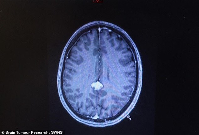 Doctors diagnosed her with a posterior falcine meningioma¿a low-grade tumour in a location too dangerous for surgery. April's brain scan is pictured above, the tumour showing in white