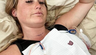 Amanda Wolaver (pictured), 33, from Georgia, thought she was 'slowly dying' after she went for her Botox top-up