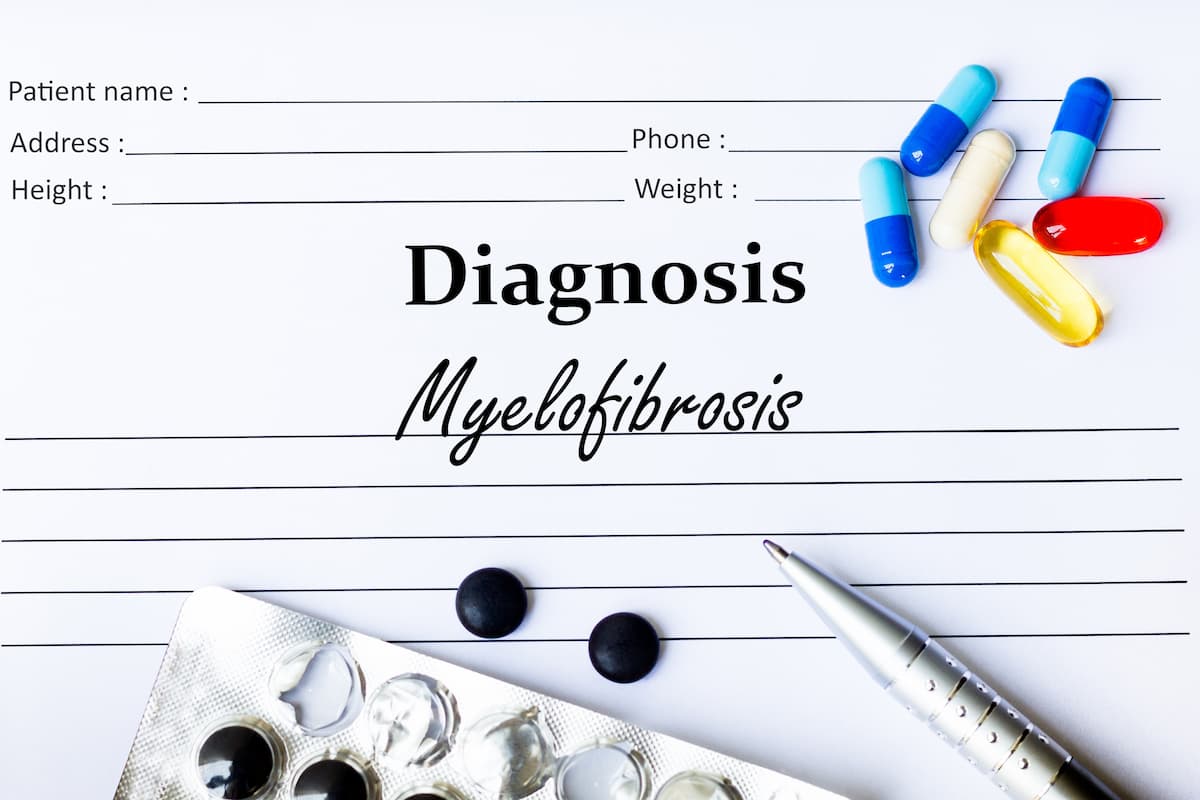 Study Identifies Potential Genetic Drivers, Targeted Treatments for AF in MPN