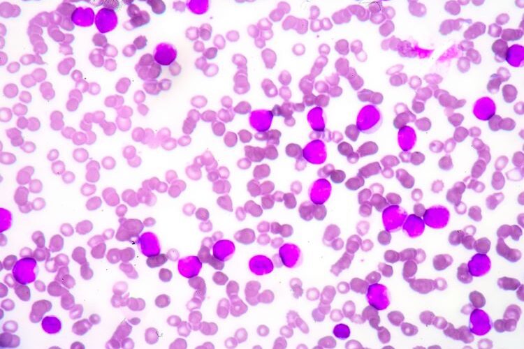 Stem cell transplant antibody