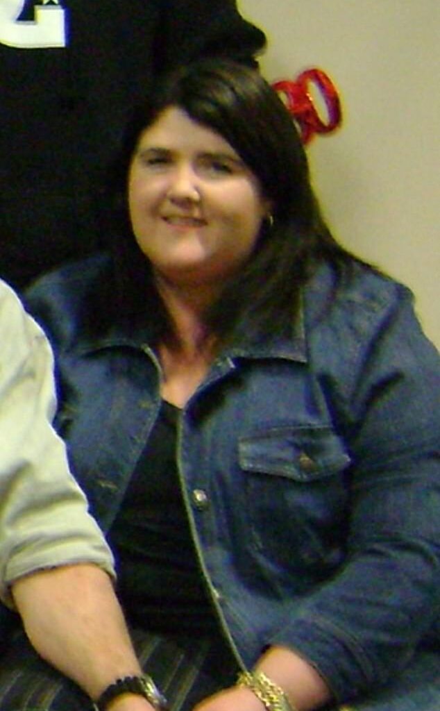 At her heaviest, Kylie weighed 154kg and decided her best bet was to have bariatric surgery