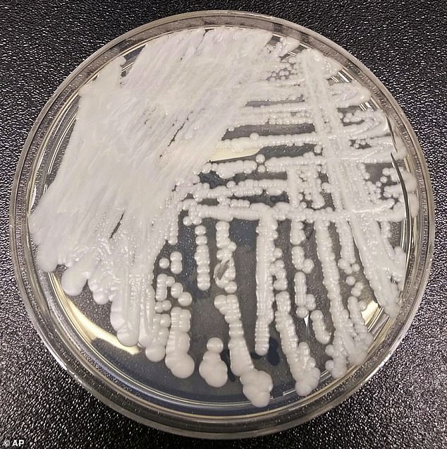 While C. auris was only discovered 16 years ago, it is already one of the world's most feared microbes and kills around a third of those infected. Pictured, a strain of Candida auris cultured in a petri dish