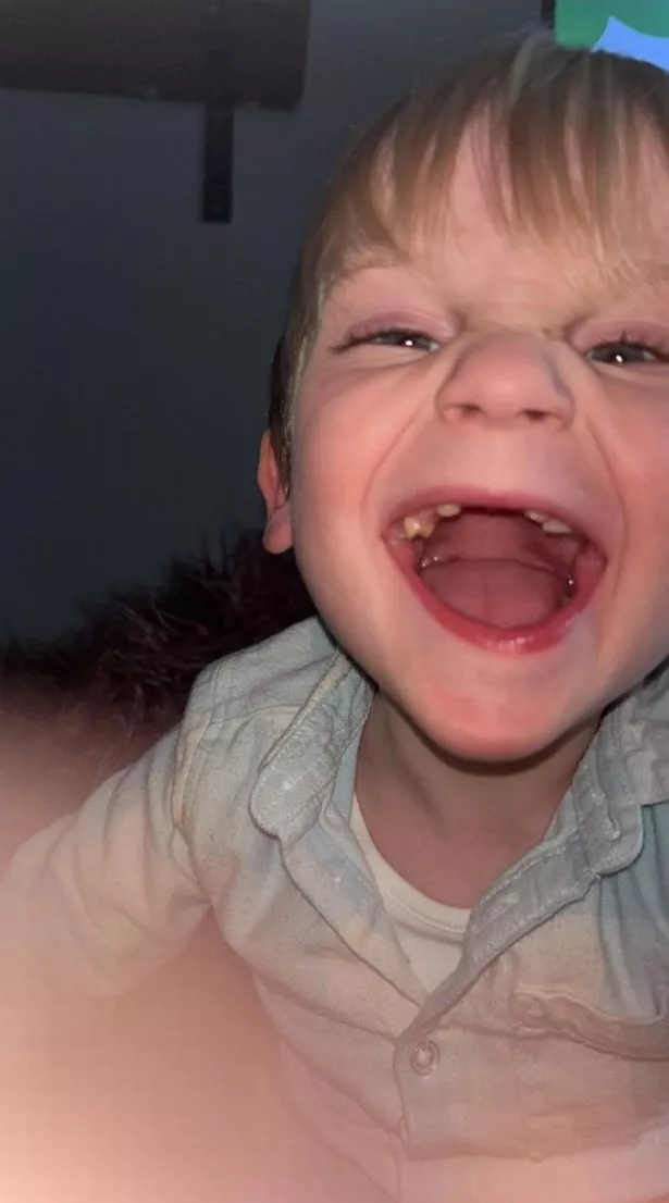 Myles’s teeth