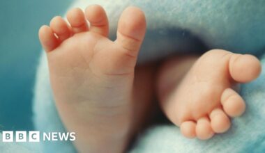Babies from three people's DNA prevents hereditary disease