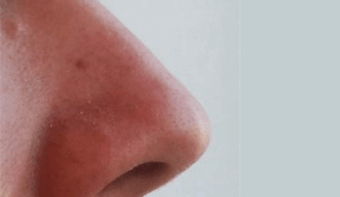 Soapy cilantro? Bitter Brussels sprouts? Coffee with a chemical aftertaste? How genes shape our differing processing of food smells