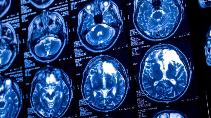 Brain scans
