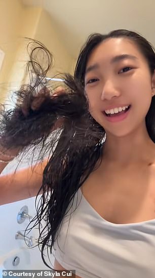 Cui is pictured above holding a clump of hair that has fallen out due to chemotherapy