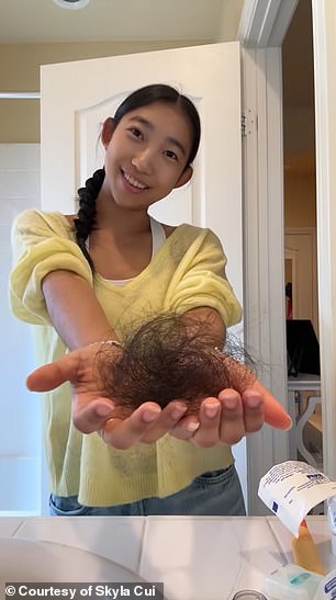 Cui is pictured above holding a clump of hair that has fallen out due to chemotherapy