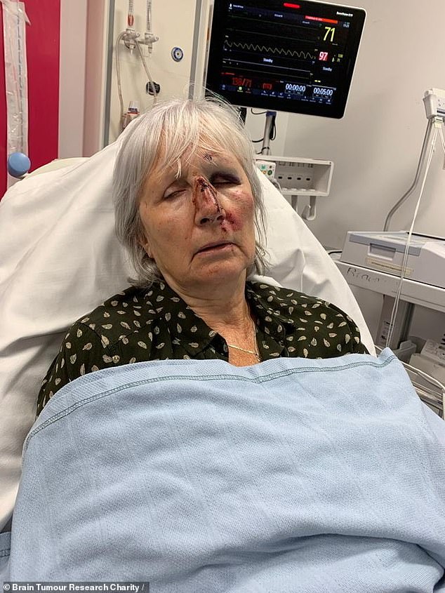 In the summer of 2021, she collapsed and was given a shocking diagnosis: a brain tumour so aggressive that without surgery she might have had only six months left