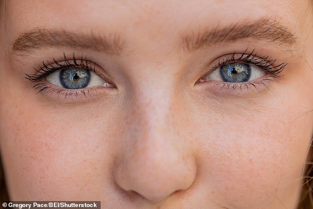 Musician David Bowie’s eyes appeared as different colours because of a permanently dilated pupil after an accident