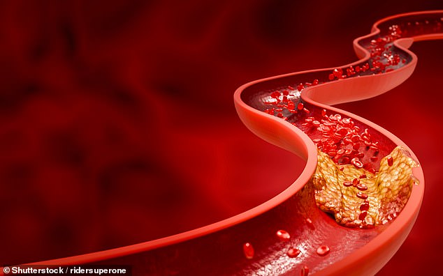 The surge of triglycerides from a single high-fat meal directly impairs the brain's ability to regulate its own blood flow, creating a vulnerable state that elevates the immediate risk for stroke and dementia