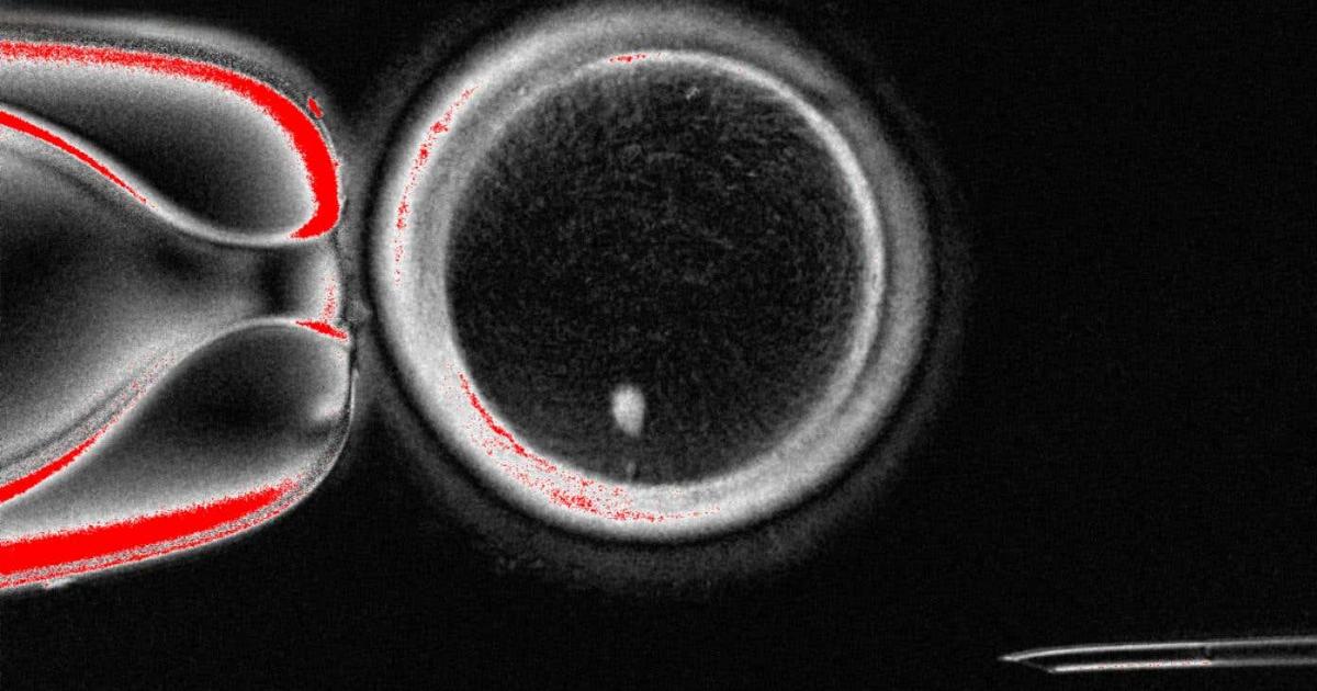 Scientists find way to fertilise eggs made from genetic material of skin cells