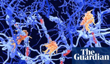 ‘Exciting’ clinical results offer hope for new class of MS therapies | Multiple sclerosis