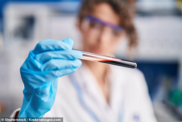 A simple blood test can tell which patients will develop motor neurone disease over a decade before symptoms appear, according to a groundbreaking study