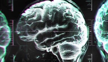 Brain Disorder Glitch Concept