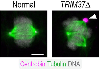 Comparison of normal cell and cell lacking TRIM37.