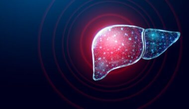 Biomarkers Identified for MASLD Using Genetics and AI