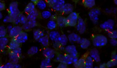 Brighter Side of News