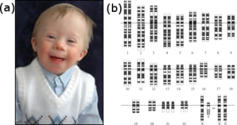 CRISPR breakthrough that can remove the chromosome responsible for Down syndrome raises ethical questions