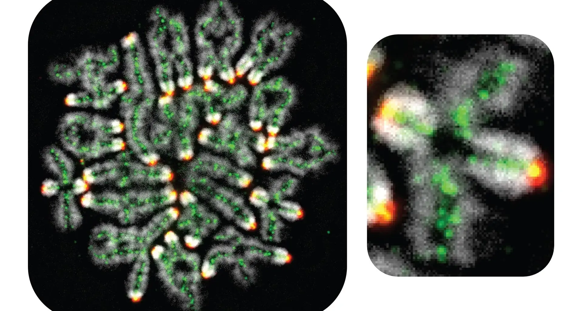 Miscarriages, down syndrome, and infertility all linked to this hidden DNA process
