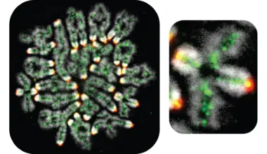 Miscarriages, down syndrome, and infertility all linked to this hidden DNA process
