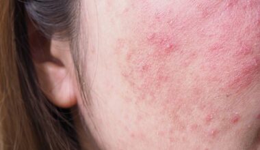 As temperatures drop and the heating goes on, many of us notice our faces feeling tighter, drier and more easily irritated¿a phenomenon dermatologists sometimes call 'autumn face'