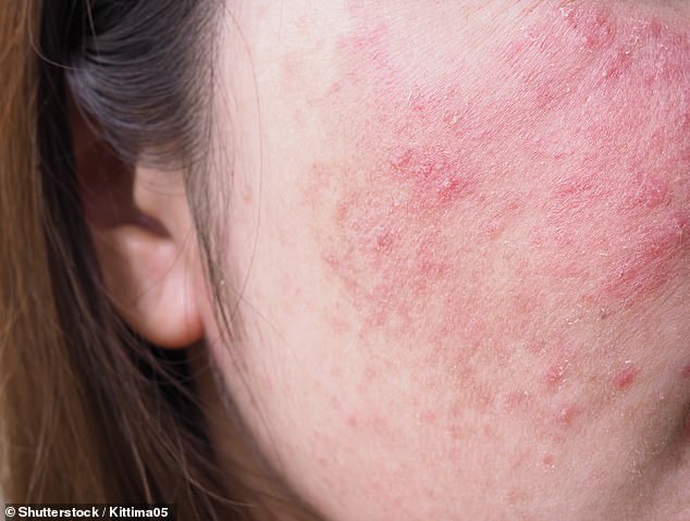 As temperatures drop and the heating goes on, many of us notice our faces feeling tighter, drier and more easily irritated¿a phenomenon dermatologists sometimes call 'autumn face'