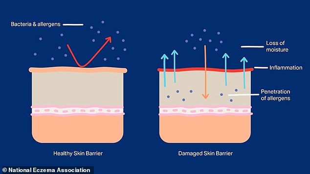 Anything that strips or overloads the skin can weaken its defences¿including harsh cleansers, over-exfoliating, sunburn, or using too many active ingredients such as retinol or acids