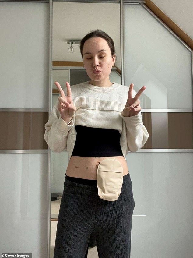 Ms Stichbury has undergone surgery and had a stoma fitted. She is also undertaking chemotherapy and has vowed to continue with it 'until it stops working'