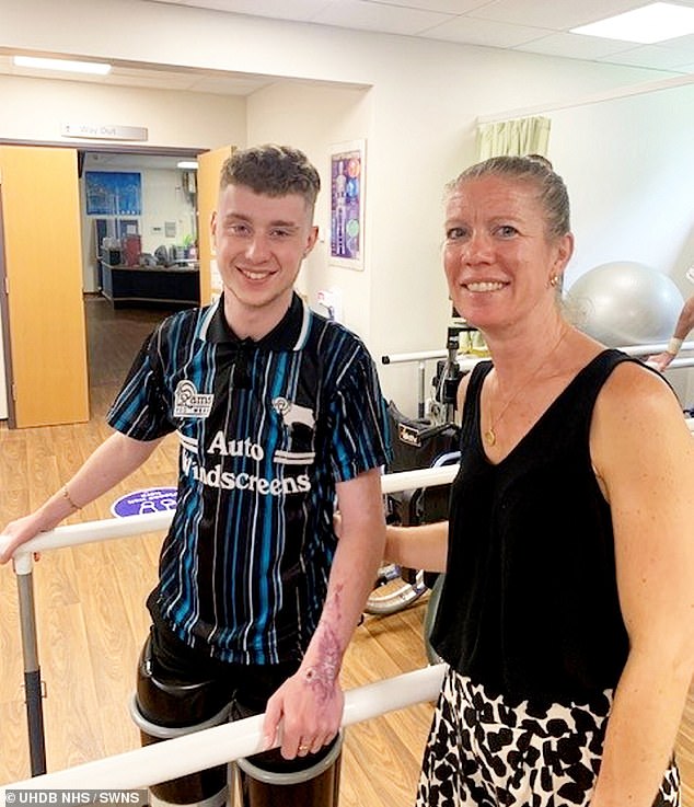 Levi made a miraculous recovery, defying all odds and since then has had to learn how to live without his legs