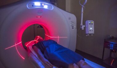 British researchers who assessed PET-CT scans¿which help diagnose and stage cancers¿discovered the injections detrimentally affected how tissue appeared on scans, which could be misinterpreted as potentially cancerous