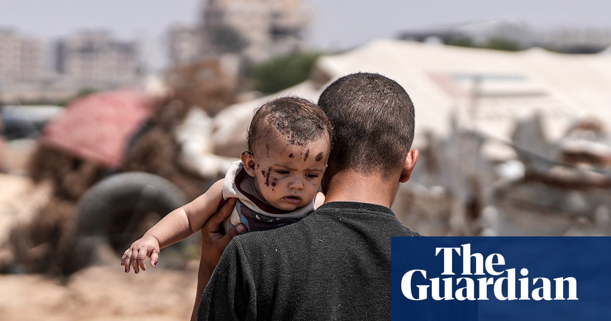 No family, no stability, no social fabric: the anguish of Gaza’s wounded orphans | Israel-Gaza war