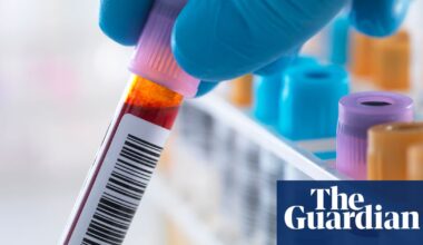 Scientists develop first ‘accurate blood test’ to detect chronic fatigue syndrome | ME / Chronic fatigue syndrome