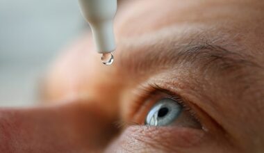 Whilst it can affect anyone of any age, contact lens wearers, older adults and women approaching menopause are particularly at risk of dry eyes, say experts