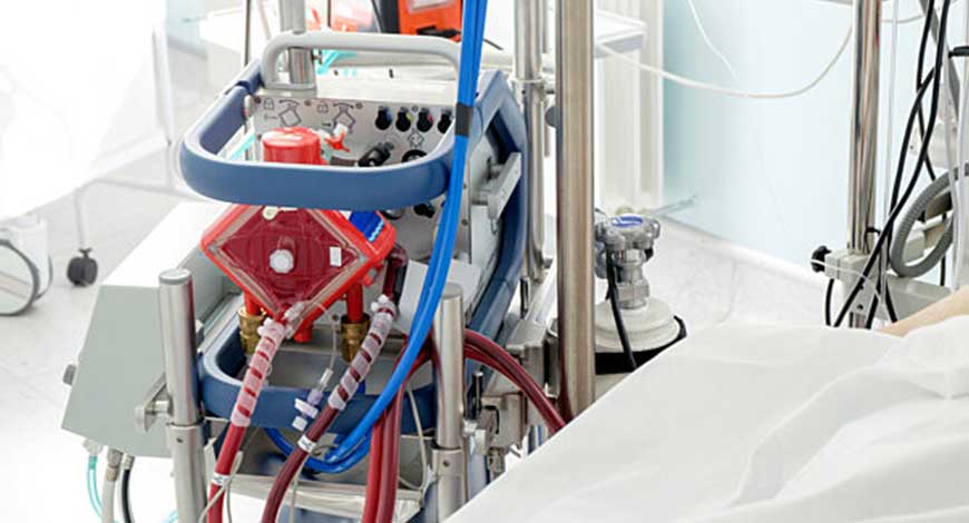 ECMO machine market to hit USD 0.86 billion – Medical Buyer