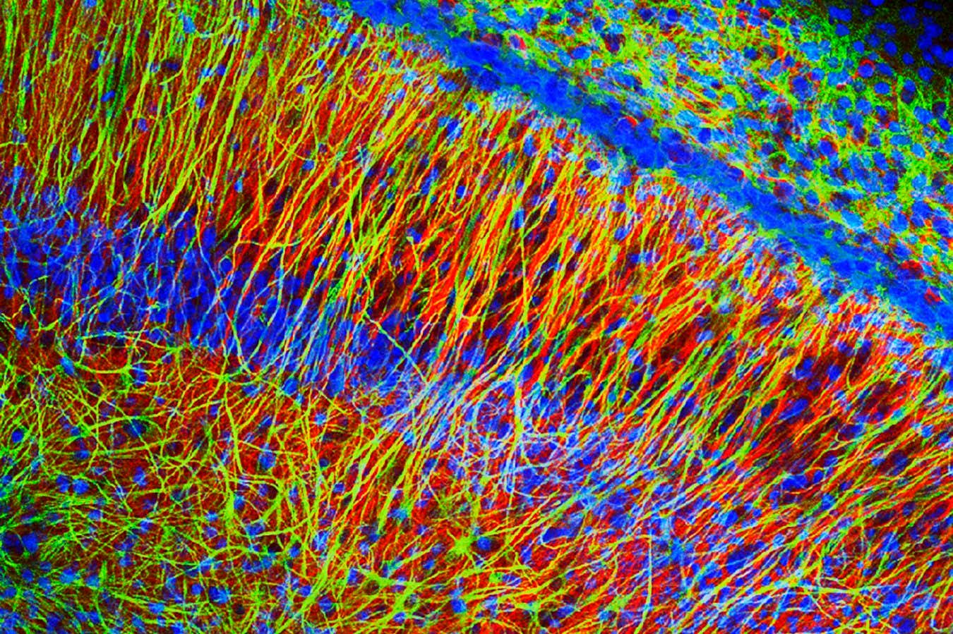 Brain cells. Fluorescence light micrograph of a section through brain tissue, showing numerous glial cells and neurons (nerve cells). Glial cells, or neuroglia, are non-neural cells of the central nervous system (CNS, brain and spinal cord). They are the predominant cell type in brain tissue and are thought to outnumber neurons by 10 to 1. Their precise roles remain to be well understood. Glial cells provide physical and functional support to neurons and participate in maintenance of the blood-brain barrier by attachments to blood vessels (as seen here).