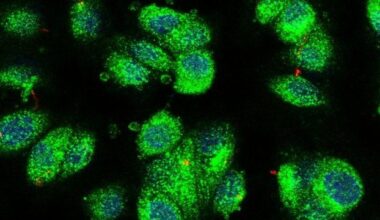 Human Cilia Atlas Offers Clues to Genetic Disorders