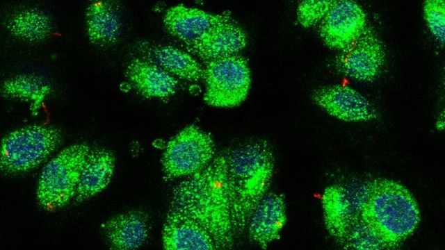 Human Cilia Atlas Offers Clues to Genetic Disorders