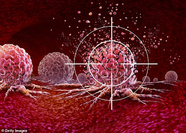 John became the first person in Europe to have a new, non-invasive procedure called histotripsy, a treatment that uses focused ultrasound waves to break down tumours