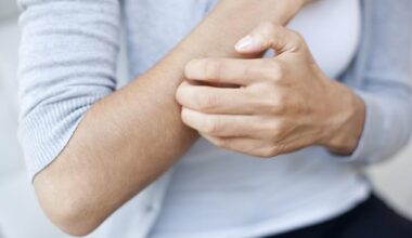 Wide-spread itching - known as generalised pruritus - can be caused by a number of factors