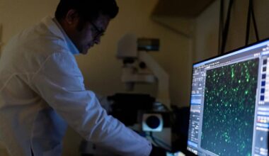 What to know about autoimmune diseases, who’s at risk, and why treatment is so hard