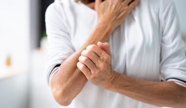 One cause of itchiness is scabies - an infestation of mites in the skin that can be incredibly itchy and may not have an obvious rash