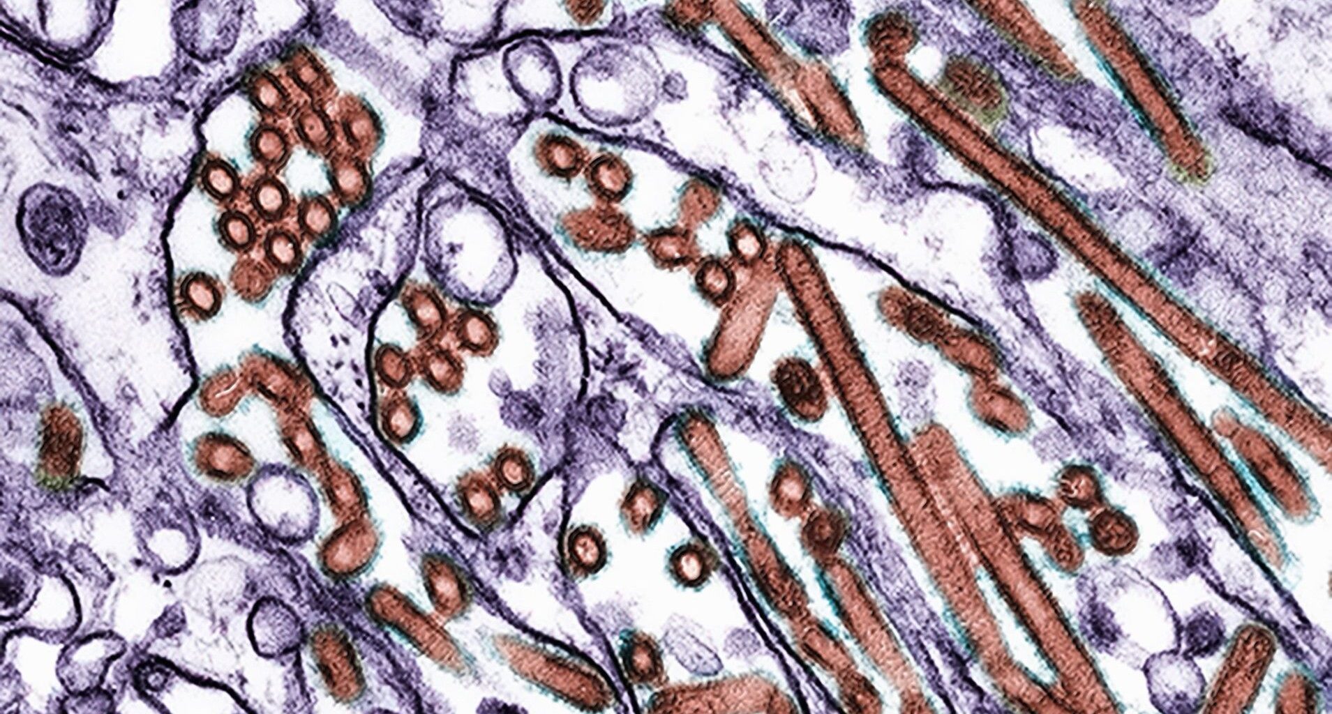 Microscope image of bird flu virus H5N1 in cells