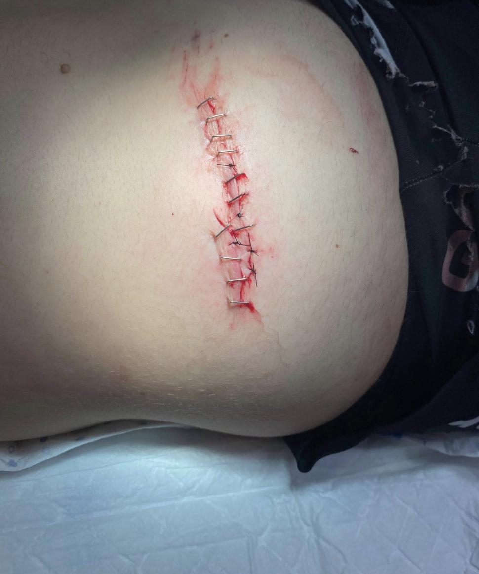 Marion Norbert Riberolle staples