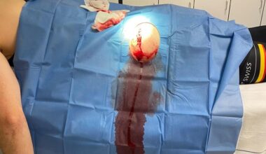 “We cyclists don’t have much to protect us”: Pro cyclist urges drivers to “be careful” after being “hit hard” by motorist who failed to give way during training session, leaving her in “pain everywhere”