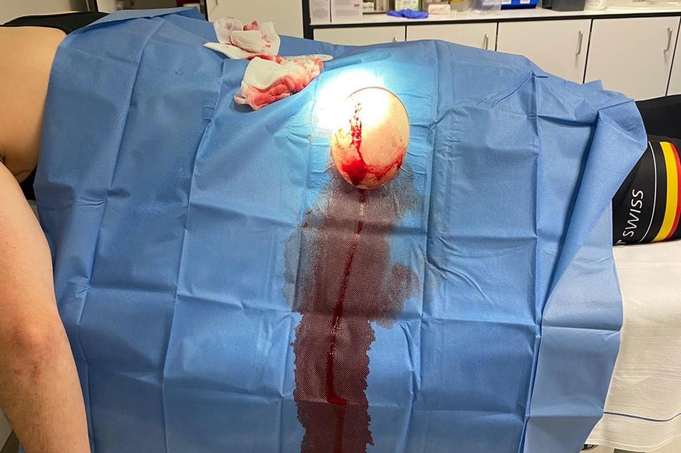 “We cyclists don’t have much to protect us”: Pro cyclist urges drivers to “be careful” after being “hit hard” by motorist who failed to give way during training session, leaving her in “pain everywhere”