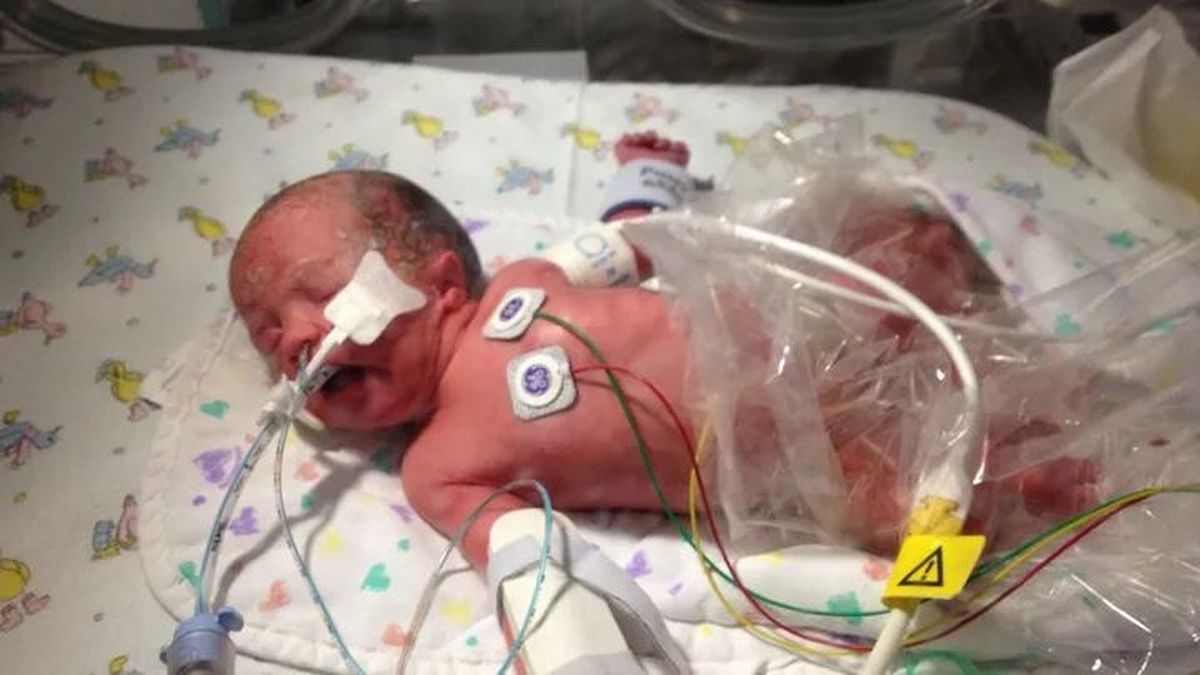 A small baby with wires connected to her 